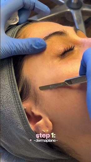Improve FINE LINES & WRINKLES With A MANDELIC PEEL! #skincare #chemicalpeel