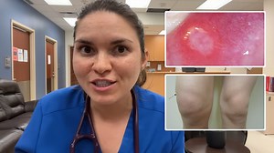 Inside a day in the life of a doctor treating toxic megacolon
