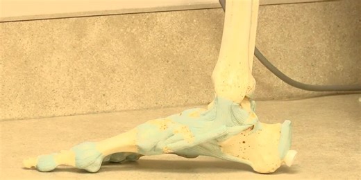 Medwatch: Local podiatrist speaks on foot and ankle health