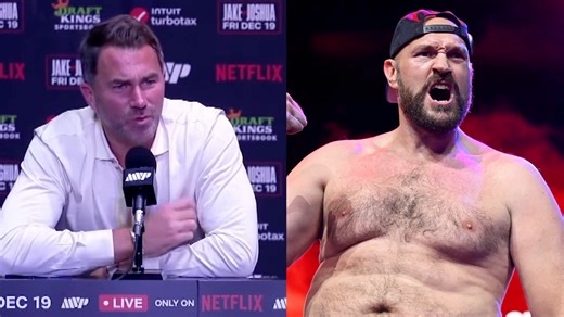 Just in case anyone was wondering who that impressionist was talking to AJ & Eddie Hearn at the press conference.. 😅🥊 | Al Foran Comedy