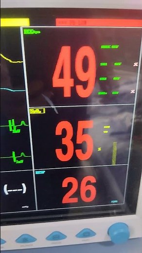How ICU Survival Depends on Mastering Hemodynamics #MedicalTraining #ICU
