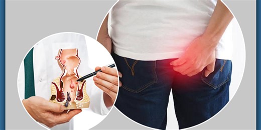 Difference Between Piles And Fissures: Know More About These Conditions