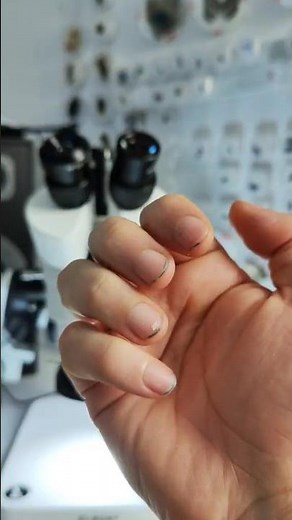 Dirt in our nails in microscope view worms live in finger nails #shorts #microscope #nails #germs