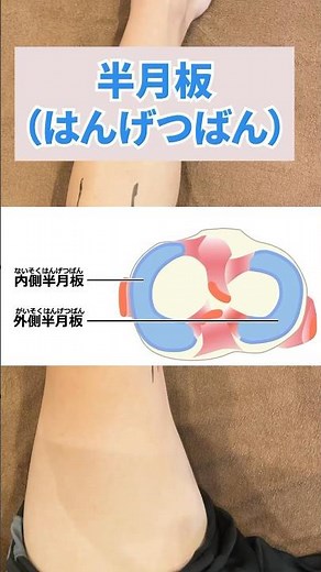 【半月板】膝の痛みの場所と原因を解説！#八尾 #膝痛 #大阪 #整体