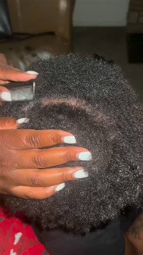 Scalp Scratching ｜ Dandruff Removal ｜ Fast Scratching #reels #dandruffscratching #Dandruff #scalpcare #reelschallenge | Yuriy Shatsky