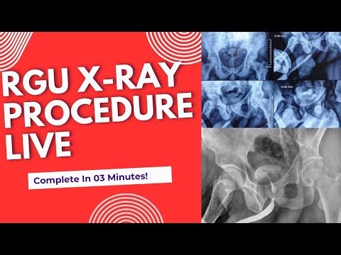 RGU X-RAY PROCEDURE LIVE