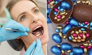 Teeth whitening: Dentist discusses at home methods