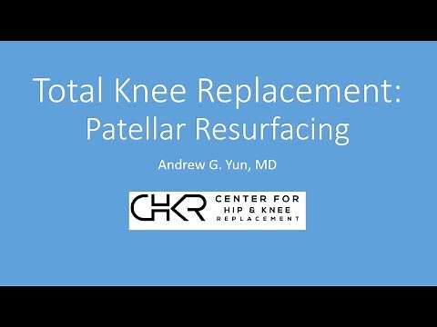 Total Knee Replacement: Patellar Resurfacing