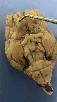 Brain Dissection Practical ( BIOL 220L - 31665 Anatomy and Physiology I Lab)
