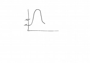 SOLVED:Each slow wave has a depolarization (not counting the action potential) of about how many millivolts (mV) ?