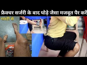 leg muscle (strengthening) weakness exercise || tibia, fibula, femur fracture recovery exercises