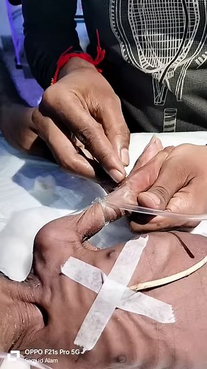 989K views · 9.5K reactions | Baby blood sample collection  #fb #motivation #medical #Nursing #GNM | The Baby Nursing STM | Facebook