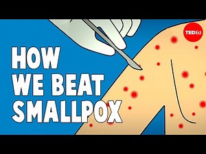 How we conquered the deadly smallpox virus - Simona Zompi