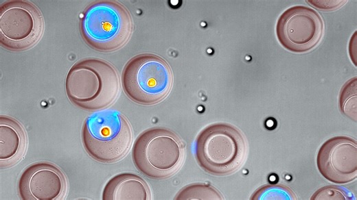 Advance in Immune Cell Screening Uncovers Receptors that Target Prostate Cancer