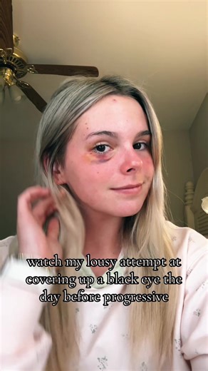 How to Cover Up a Black Eye for Semi-Formal Events