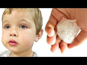 🌩Huge HAIL Storm!