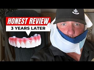 Do 24-Hour Dental Implants Actually Last? My 3-Year Review