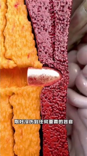 benefits of excessive Fat 😲 #facts #animatedfunny #didyouknow #history