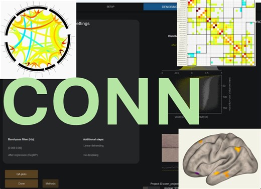 CONN功能连接系列视频-01 准备工作，软件和数据 | 静息态任务态fMRI 功能连接 ALFF REHO