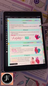 EKG Flashcards 249  With Hyperlinked | Medical Nursing Study | Cardiac Study Guide | Ekg Rhythms | Electrocardiogram | Free Cover Pages - Etsy