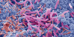 Autism affects the microbiome, not the other way around