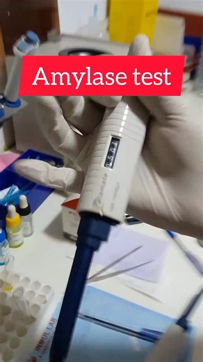 Understanding the Amylase Test for Medical Professionals