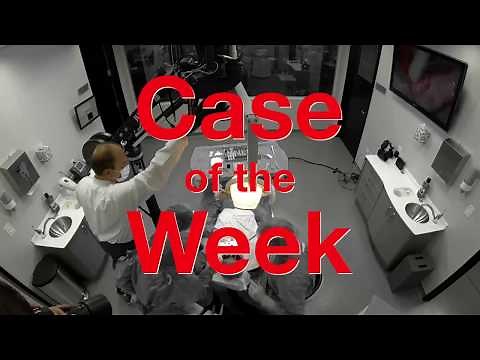 Case of the Week: Obsidian® All-Ceramic Crown Milled Chairside