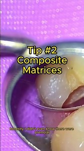 Did You Know They Have Premolar Ones?!