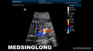 Mindray DC-26 Medical Ultrasound Instruments 3D/4D Trolley Color Ultrasound Machine with 15-inch LED Monitor