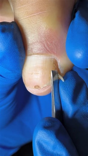 6.9K views · 18 reactions | #pedicure | Nail Salon | Facebook