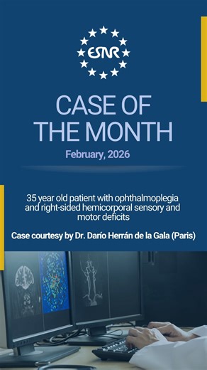 🧠 ESNR Case of the Month | February 2026 Diagnosis: Neuro-Behçet Disease Clinical Presentation: A 35-year-old male presenting with acute ophthalmoplegia and right-sided hemicorporal sensory and motor deficits. Key Imaging Findings: MRI FLAIR: Mesodiencephalic junction hyperintensity displaying the “cascade sign”. Multimodal MRI: Evidence of hemorrhagic remnants (SWI), focal cytotoxic edema (DWI), and punctate enhancement (T1 C). Vascular: Arterial and venous MRA were notably normal. Diagnosis &