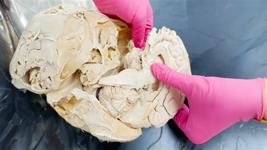 Soft helmet of the brain