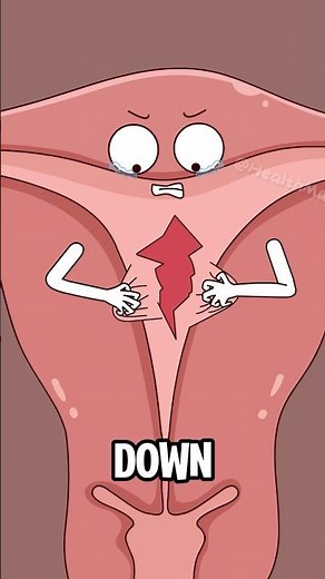 Why do you experience menstrual cramps?#funny #shorts #hot