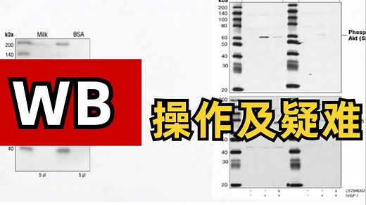 【Western blot 】WB实验操作要点及疑难排解
