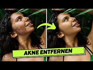 Akne retuschieren in 4 Schritten!🔸 Photoshop Tutorial ( German/Deutsch )