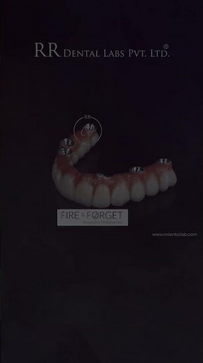 Its RR Dental Lab- Best dental lab in India