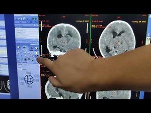 CT GE, loop feature to straighten images, don't need to batch! Retro reconstruction