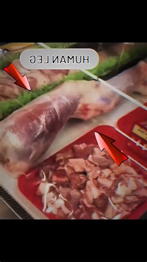 The Human Leg Case: A True Horror Story