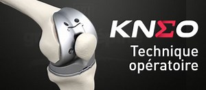 La técnica quirúrgica KNEO™