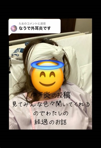 @たおに返信 わたしは去年の4月に風邪をひいて副鼻腔炎になり、中耳炎になりました。 急激に悪化して左耳が聞こえないなあって思った夜。激痛で起きて、助けて、救急車呼んで！と意識朦朧とするくらいの激痛でそのうち血が出てきて病院行ってすぐに鼓膜切開しました。 その後も良くならなく病院に通っていてめまいで倒れました。内耳炎になっていました。鼓膜が分厚くなっていて局所麻酔では激痛で耐えられないと判断され入院して全身麻酔で鼓膜チューブを挿入しました。その後も良くならなく大学病院に行き、乳突洞削開術を受けました。めちゃくちゃ怖かったし痛かったです笑。2枚目の写真がその手術後です。そして今どうかというとまだ治ってません。耳の聞こえが悪く、今後また手術も視野に…ってなってます🥲大人の中耳炎は、長引き重症化しやすいみたいです。。毎日辛いですが、この耳の聞こえ方や、耳に心臓がある感じも慣れちゃいました😂治療頑張ります❤️‍🩹 鼻詰まりはすぐに解消したほうがいいです。強く鼻を噛んだり、鼻を啜らないですぐに耳鼻科に行き開通しましょう！ #耳鼻科#中耳炎#外耳炎#内耳炎#こんなことになるとは
