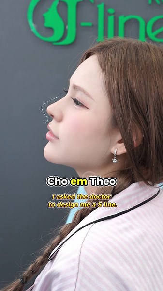 Một trong những lí do nên nâng mũi S-Line Trung Hoa #fyp #jline #nangmuicautruc #nangmuiphongthuy #nangmuidouyin