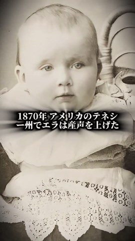 世界最恐の奇形人間10選