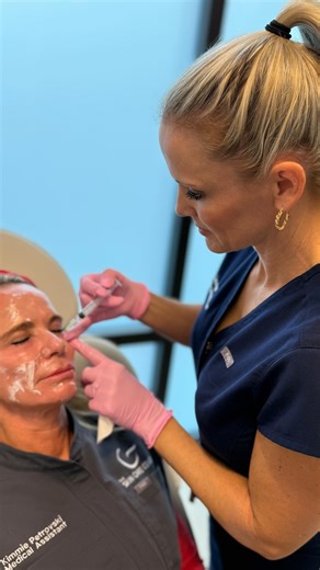 We combined PDGF injections under the eyes with a full-face DEKA CO2 laser treatment for one powerful session! Together, these treatments target both deep tissue repair and surface-level rejuvenation for beautiful, natural results. The Deka CO2 laser not only enhances the effects of PDGF but also helps break up and minimize bruising, speeding up recovery and leaving the under-eye area smoother and brighter. If you’re interested in this advanced combo treatment, schedule a consultation with one o