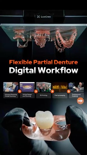 LuxCreo FPD Digital Workflow For Labs and Clinics