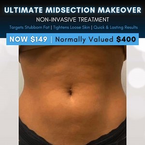 👋 Ladies on Long Island & SURROUNDING AREAS! Achieve a slimmer look with our Non-Invasive Ultimate Midsection Makeover. Say goodbye to stubborn belly fat and cellulite, and hello to a more defined waistline 🔥 Our advanced technology targets fat cells, tightens skin, and reduces cellulite—no needles, no downtime! Here’s why this treatment is perfect for you... 💎 Enhances your natural shape 💎 Focuses on stubborn fat and cellulite 💎 Completely non-invasive with no recovery time 💎 Look and fee