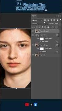 ✨ How to Remove Pimples and Clean Skin in #photoshop | Quick Retouch Tutorial 💻