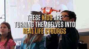 126K views · 143 reactions | Child cyborgs? It’s not a new sci-fi movie, it’s the future of prosthetics. | HistoryNow | Facebook