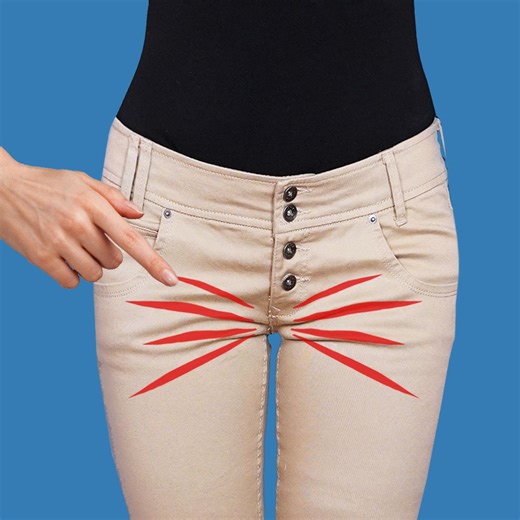 88K views · 487 reactions | Toller Nähtipp, wie man Falten in Hosen ganz einfach repariert! | Miarti - Kreative ideen | Facebook