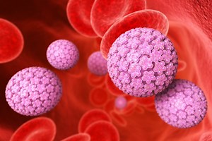 HPV: symptoms, diagnosis and treatment of the papillomavirus