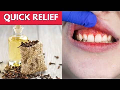 How to make Clove Oil for Toothache ( Quick Ways to Relieve a Toothache at home)